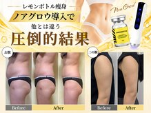 ビーズスタイル(B’S STYLE)の雰囲気（レモンボトル痩身◆効果重視のノアグロウ導入でサイズダウン！）