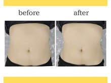 デサフィオ(Desafio)/人気No2全身コースbefore→after