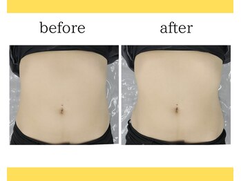 デサフィオ(Desafio)/人気No2全身コースbefore→after