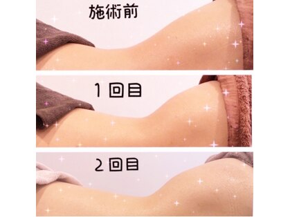 ルミネ(Lumine)の写真