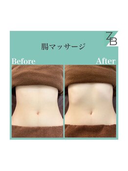 ザラハビューティー(ZARAHA Beauty)/腸セラピー