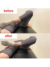 ナオル整体 福岡香椎院(NAORU整体)/40代女性施術事例【股関節】