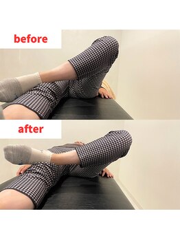 ナオル整体 福岡香椎院(NAORU整体)/40代女性施術事例【股関節】