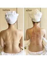 リュクス(Luxe)/ビフォーアフター（30代）