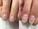 爪はいつからでも変えられる！