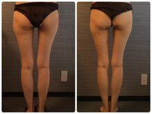 美容整体 ウェリナ 蟹江院/小顔矯正/骨盤矯正/美脚サロン