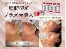 アンフィア(Anfia)の雰囲気（今年8月に韓国から導入！エステでも脂肪解消できる最新美容◇）