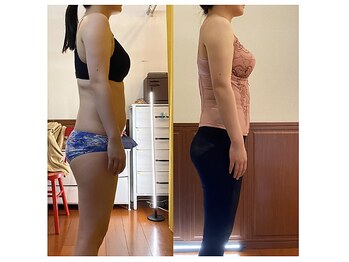 ベンザイ 梅田店(BENZAI)/骨格調整、日頃のケア大事