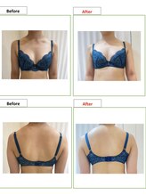 エステティック レイビス 銀座店(RAYVIS)/バスト