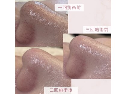 毛穴研究所の写真