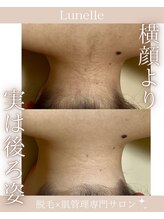 ルネル(Lunelle)/手が届かないからこそお任せ☆