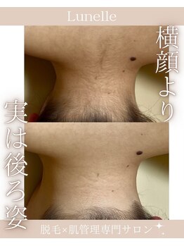 ルネル(Lunelle)/手が届かないからこそお任せ☆