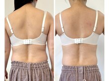 リソラ(risora)/40代バストケア1回 