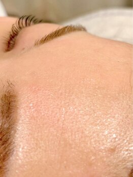 モアビューティ 本通り店(MORE BEAUTY)の写真/《フェイシャルワックス脱毛でお顔のツヤ感UP！¥8,000》うる艶ちゅるんな赤ちゃん肌をGET♪