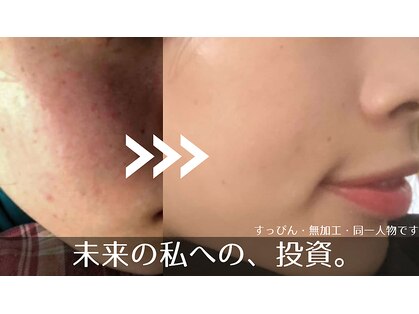 ニコラフ(Nico laugh)の写真