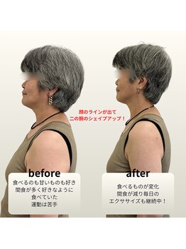 ウィータ とうの鍼灸整骨院(vita)の写真/【3ヵ月集中コース★夏までに理想の身体に!】根本から美しく◎自信が持てるボディラインへ!