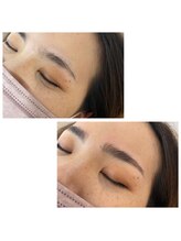 モル(Molu)/ハリウッドブロウリフト