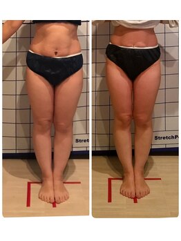 フェリシテ(Felicite)/ビフォーアフター