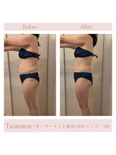 エミル(Emillu)/＊Body_ビフォーアフター