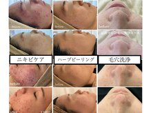 カラン(CALIN)の雰囲気（肌悩みに応じたメニューがあります。一度ご相談下さい）