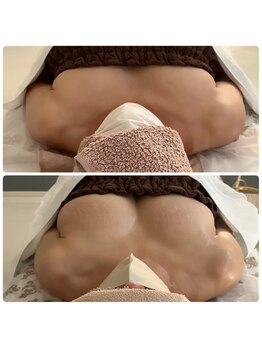 カナエルサロン 旭川(KANAERU SALON)/小顔（コルギ）もメニューも◎