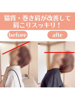 整体天使のはね 福山店/【猫背/巻き肩】整体で劇的改善