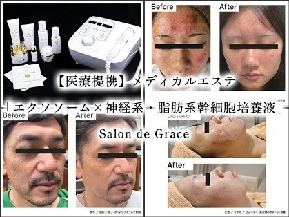サロン ド グレース(Salon de Grace)の写真