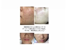 エステティックサロン さら