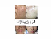 エステティックサロン さら