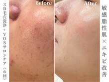 ゼアー(THERE FY.)の雰囲気（あらゆる肌悩みに変化を。肌診断で最適なメニューをご提案♪）