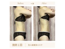 リスキン(Re:Skin)の雰囲気（運動しなくても美しいプロポーションに）