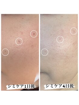 エメリア(Emelia)/