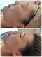 リノ(Lino)の写真/【40代からのたるみケア】ほうれい線・二重アゴも劇的変化!深層コルギ×最新マシンで速攻引き締め小顔