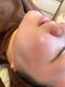 ひだまり。の写真/フェイシャルWaxで産毛・古い角質をオフ！つるんと透明感あふれる水光肌へ♪