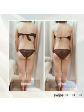 リアン(Lien)/before after