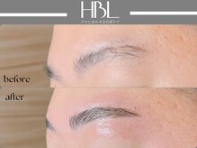 アポロ(Apollo)/ハリウッドブロウリフト