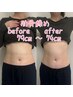 【肋骨締め・骨盤締め】痩身/クビレ/スタイル/リンパ♪100分¥15000→￥10000