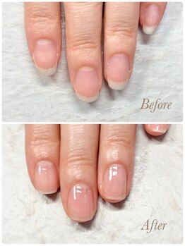 ソワン(soin)/Before→After