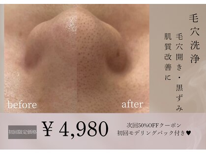 イルナ(ILUNA)の写真