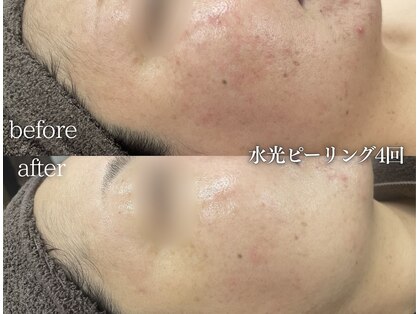 ミレット(Miretto)の写真