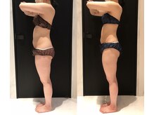 リボディ 表参道(An re Body)/before→after