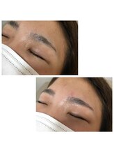 モル(Molu)/ハリウッドブロウリフト