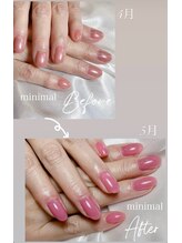 ミニマル(minimal)/自爪育成