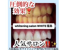 ホワイトニングサロン ホワイト(WHITE)/セルフホワイトニング/大阪/福島