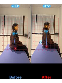 松戸駅前鍼灸院 整骨院/骨盤矯正＆全体矯正生涯の体作り