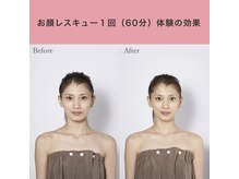 リュクス(Luxe+TKM HANATEN)/華奢みえ小顔コルギ