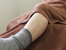 はやかわ鍼灸整骨院/スポーツ鍼灸・メンテナンス