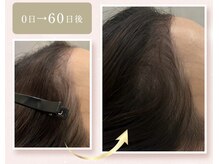 フロリール アザブジュウバン(FlorirAzabujuban)の雰囲気（《麻布十番/育毛促進/抜け毛/薄さ/生え際矯正》）