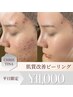【平日限定◆本気の肌質改善】剥離なしピーリング7種 