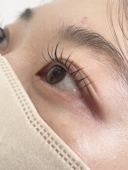 アリビオ(Alivio)/